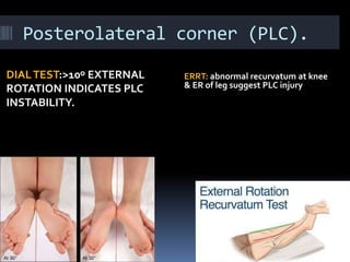 Posterolateral corner (PLC).
DIALTEST:>10ᵒ EXTERNAL
ROTATION INDICATES PLC
INSTABILITY.
ERRT: abnormal recurvatum at knee
& ER of leg suggest PLC injury
 