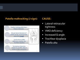 Patella maltracking (J-sign): CAUSE:
 Lateral retinacular
tightness
 VMO deficiency
 Increased Q angle
 Trochlear dysplasia
 Patella alta
 