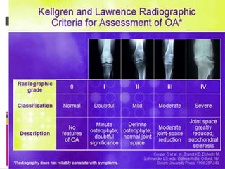 Knee clinical examination by Dr YAGNIK