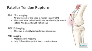 Pocus Modality Knee Extensor Mechanism Injuries - Orthopedic Radiologic Imaging | PDF