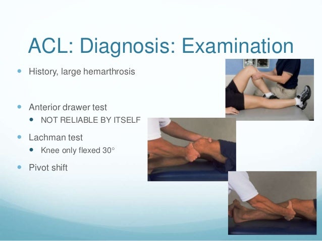 Knee Sports Injuries