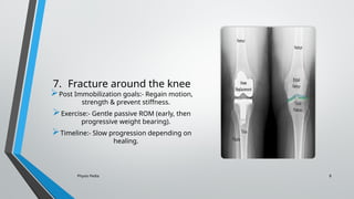 Physio Pedia 8
7. Fracture around the knee
Post Immobilization goals:- Regain motion,
strength & prevent stiffness.
Exercise:- Gentle passive ROM (early, then
progressive weight bearing).
Timeline:- Slow progression depending on
healing.
 