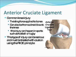 Knee Injury[3] | PPT