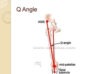 Q Angle
 