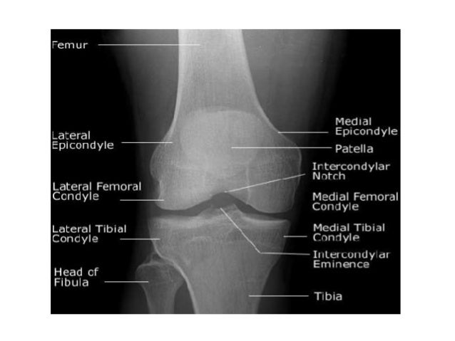 Anatomy And Clinical Importance Of Knee Joint