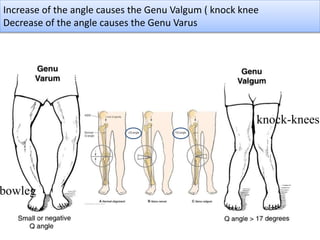 Increase of the angle causes the Genu Valgum ( knock knee
Decrease of the angle causes the Genu Varus
bowleg
knock-knees
 
