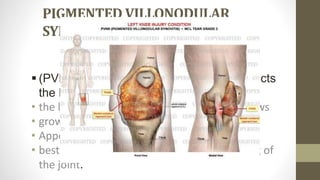 Pvns Rash Knee joint(1) | PPTX