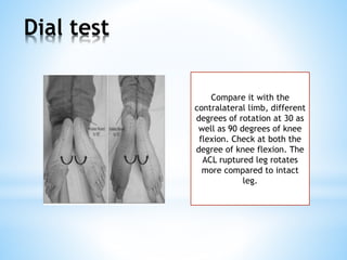 Dial Test Knee joint anatomy, biomechanics, pathomechanics and assessment | PPTX
