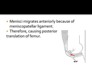  Menisci migrates anteriorly because of
meniscopatellar ligament.
 Therefore, causing posterior
translation of femur.
 