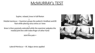 Mcmurray Testing Knee Joint Examination orthopaedics .pptx