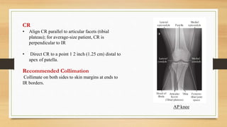 Knee joint (Radiographic projection's) | PPTX