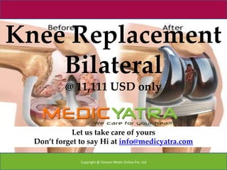 Knee Replacement
    Bilateral
          @ 11,111 USD only


             Let us take care of yours
  Don’t forget to say Hi at info@medicyatra.com

               Copyright @ Forever Medic Online Pvt. Ltd
 
