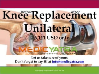 Knee Replacement
   Unilateral
           @ 6,111 USD only


             Let us take care of yours
  Don’t forget to say Hi at info@medicyatra.com

               Copyright @ Forever Medic Online Pvt. Ltd
 