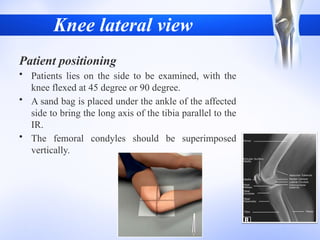Knee Joint X-Ray Views & Positioning Techniques.pptx