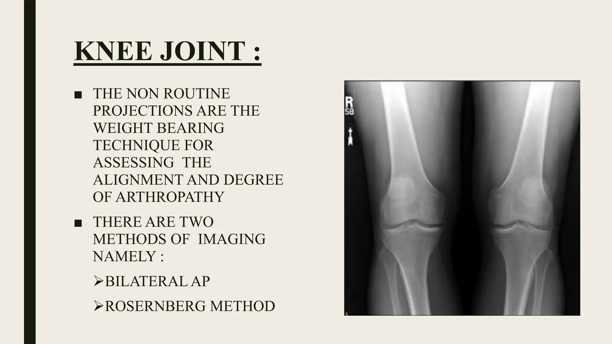 radiography positioning of knee and leg | PPTX