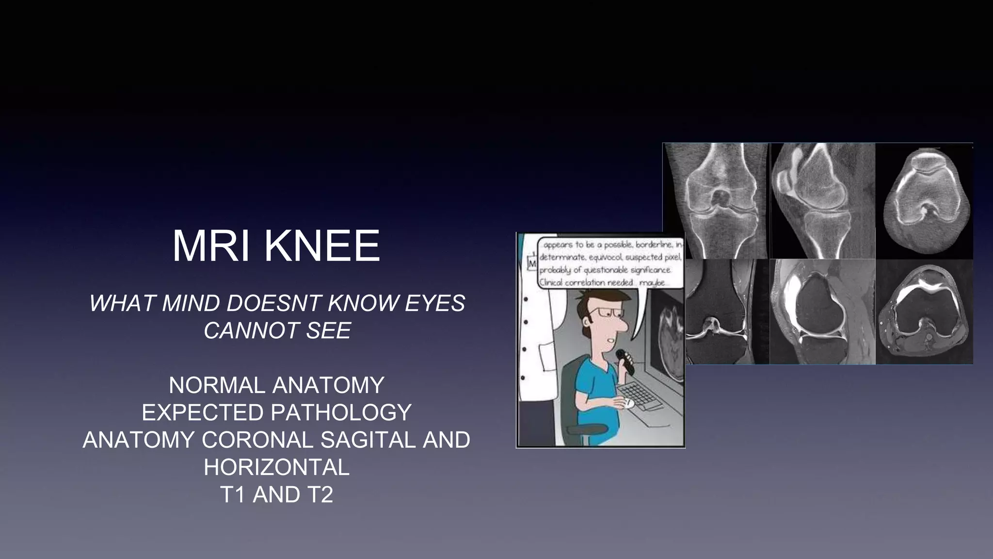 MRI KNEE
WHAT MIND DOESNT KNOW EYES
CANNOT SEE
NORMAL ANATOMY
EXPECTED PATHOLOGY
ANATOMY CORONAL SAGITAL AND
HORIZONTAL
T1 AND T2
