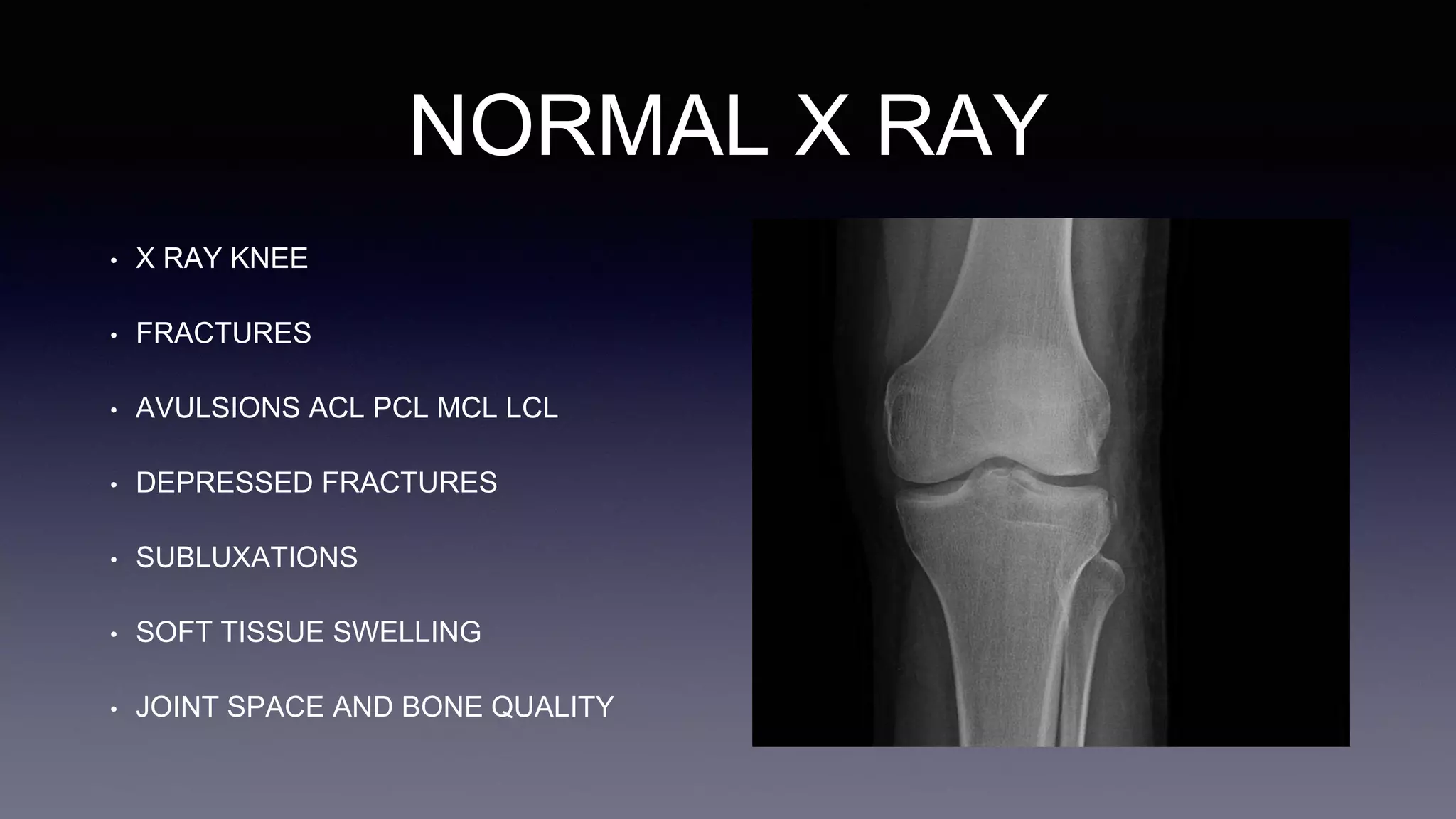 NORMAL X RAY
• X RAY KNEE
• FRACTURES
• AVULSIONS ACL PCL MCL LCL
• DEPRESSED FRACTURES
• SUBLUXATIONS
• SOFT TISSUE SWELLING
• JOINT SPACE AND BONE QUALITY