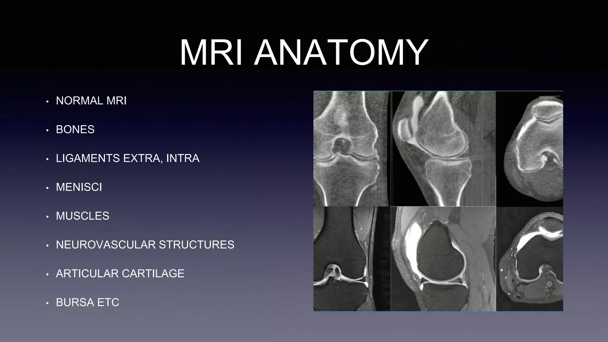 MRI ANATOMY
• NORMAL MRI
• BONES
• LIGAMENTS EXTRA, INTRA
• MENISCI
• MUSCLES
• NEUROVASCULAR STRUCTURES
• ARTICULAR CARTILAGE
• BURSA ETC