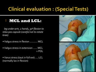 

MCL and LCL:

leg under arm, 2 hands, 30º flexion to
relax pos capsule (careful not to rotate
knee)
• Valgus stress in flexion ........... MCL
• Valgus stress in extension …... MCL
+ POL
• Varus stress (taut in full ext) .... LCL
(normally lax in flexion)

 