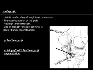2- Allograft :
Achilis tendon allograft graft is recommended :
- The osseous portion of the graft
- Has high tensile strength.
- Size and length for easily splitting in
-double bundle reconstruction.

3- Synthetic graft
Synthetic graft
augmentation

4- Allograft with Synthetic graft
augmentation.

 