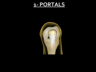 1- PORTALS

 