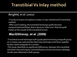 Bergfeld, et al. (2001)
-A study on 6 pairs of cadaveric knees, 6 inlay method and 6 transtibial
method.
-After cyclic loading, the transtibial technique grafts became
compromised and failed, that is because" killer turn” that the graft
makes at the mouth of the transtibial tunnel.

  MacGilliravay, et al. (2006)
-Transtibial tunnel technique with quadrupled hamstring autograft group
on 21 knees was used and the tibial inlay technique with bone–patellar
tendon–bone autograft on 22 knees.
-The study identified no significant differences between the transtibial
and tibial inlay techniques, and satisfactory clinical and stress radiologic
results were obtained in both groups

 
