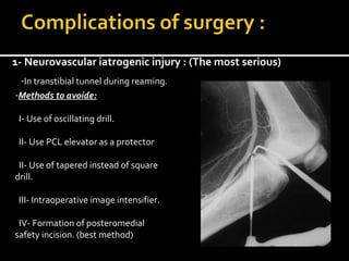 1- Neurovascular iatrogenic injury : (The most serious)
-In transtibial tunnel during reaming.
-Methods to avoide:
I- Use of oscillating drill.
II- Use PCL elevator as a protector
II- Use of tapered instead of square
drill.
III- Intraoperative image intensifier.
IV- Formation of posteromedial
safety incision. (best method)

 
