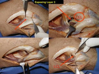 Exposing Layer 3

LCL

LCL

 