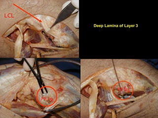 LCL
Deep Lamina of Layer 3

PF lig.
PF lig.

 