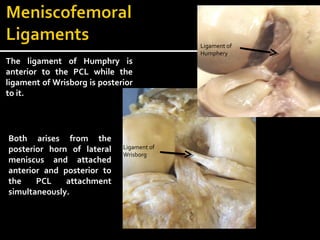 The ligament of Humphry is
anterior to the PCL while the
ligament of Wrisborg is posterior
to it.

Both arises from the
posterior horn of lateral
meniscus and attached
anterior and posterior to
the
PCL
attachment
simultaneously.

Ligament of
Wrisborg

Ligament of
Humphery

 