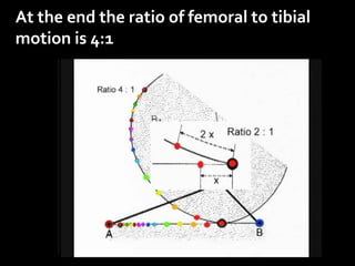 At the end the ratio of femoral to tibial
motion is 4:1

 