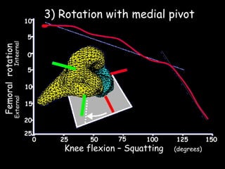 3) Rotation with medial pivot

External

Femoral rotation

Inteernal

10
5
0
5
10
15
20
25

0

25

50

75

100

Knee flexion – Squatting

125
(degrees)

150

 