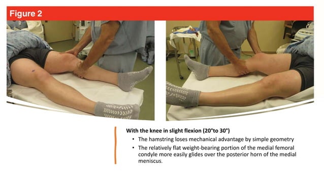 knee ligaments injury Examination.pptx
