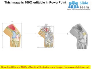 Knee medical images for power point | PDF