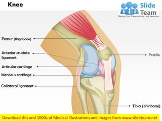 Anterior cruciate
ligament
Meniscus cartilage
Collateral ligament
Articular cartilage
Patella
Femur (thighbone)
Tibia ( shinbone)
Knee
 