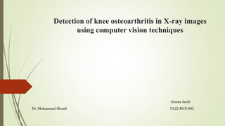 Detection of knee osteoarthritis in X-ray images
using computer vision techniques
Aleena Jamil
Dr. Muhammad Shoaib FA22-RCS-002
 