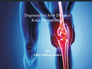 Degenerative Joint Diseases
Knee Osteoarthritis
BY
Dina Othman Shokri
 