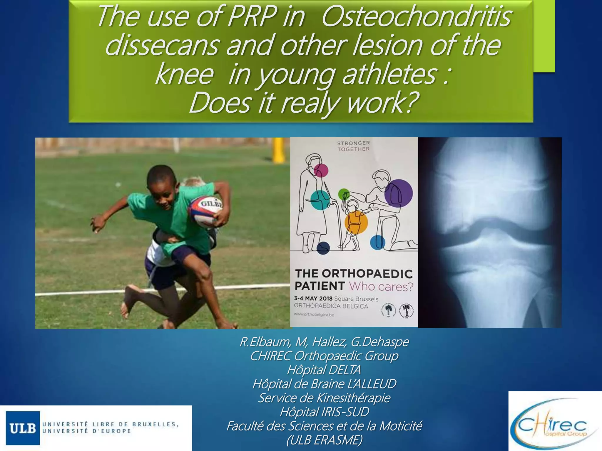 Knee osteochondritis and platelet rich plasma | PPTX