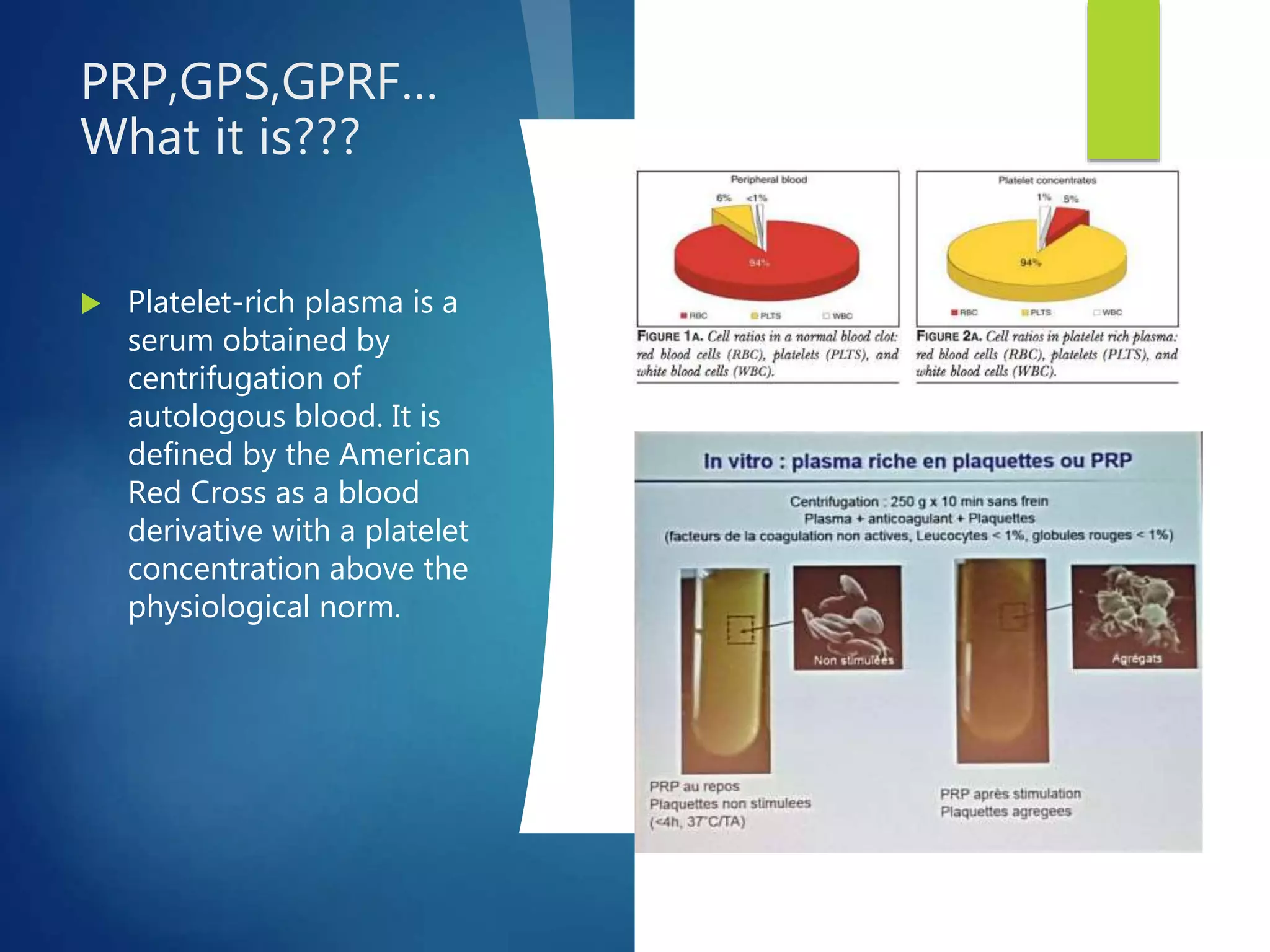 Knee osteochondritis and platelet rich plasma | PPTX