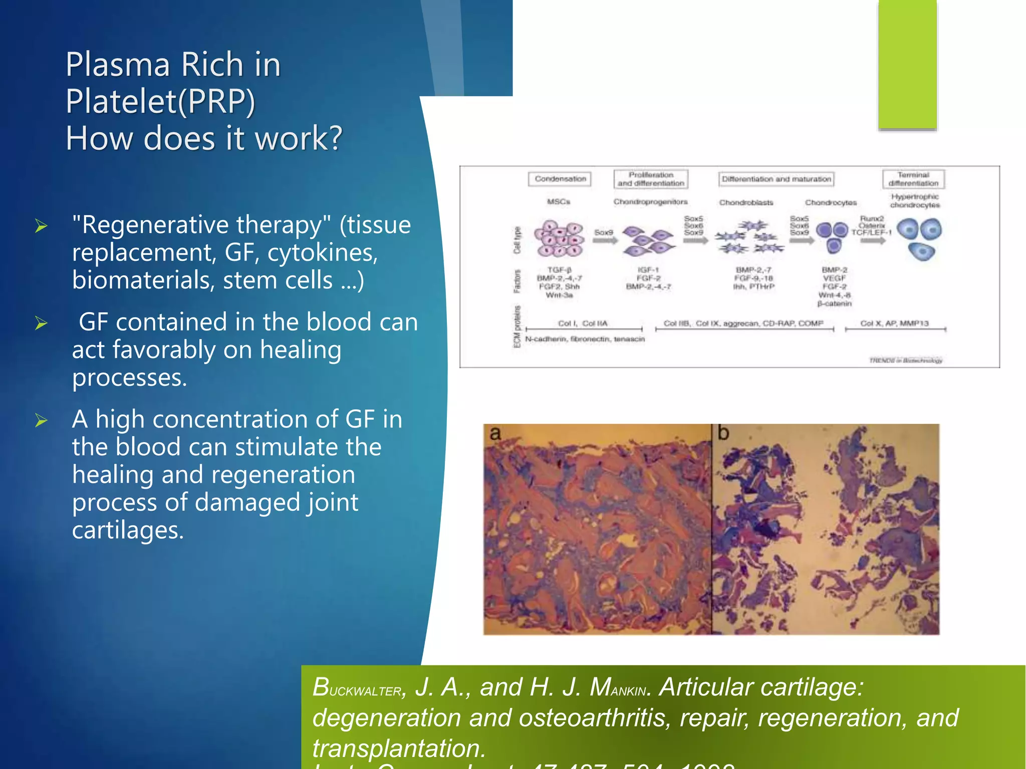 Knee osteochondritis and platelet rich plasma | PPTX