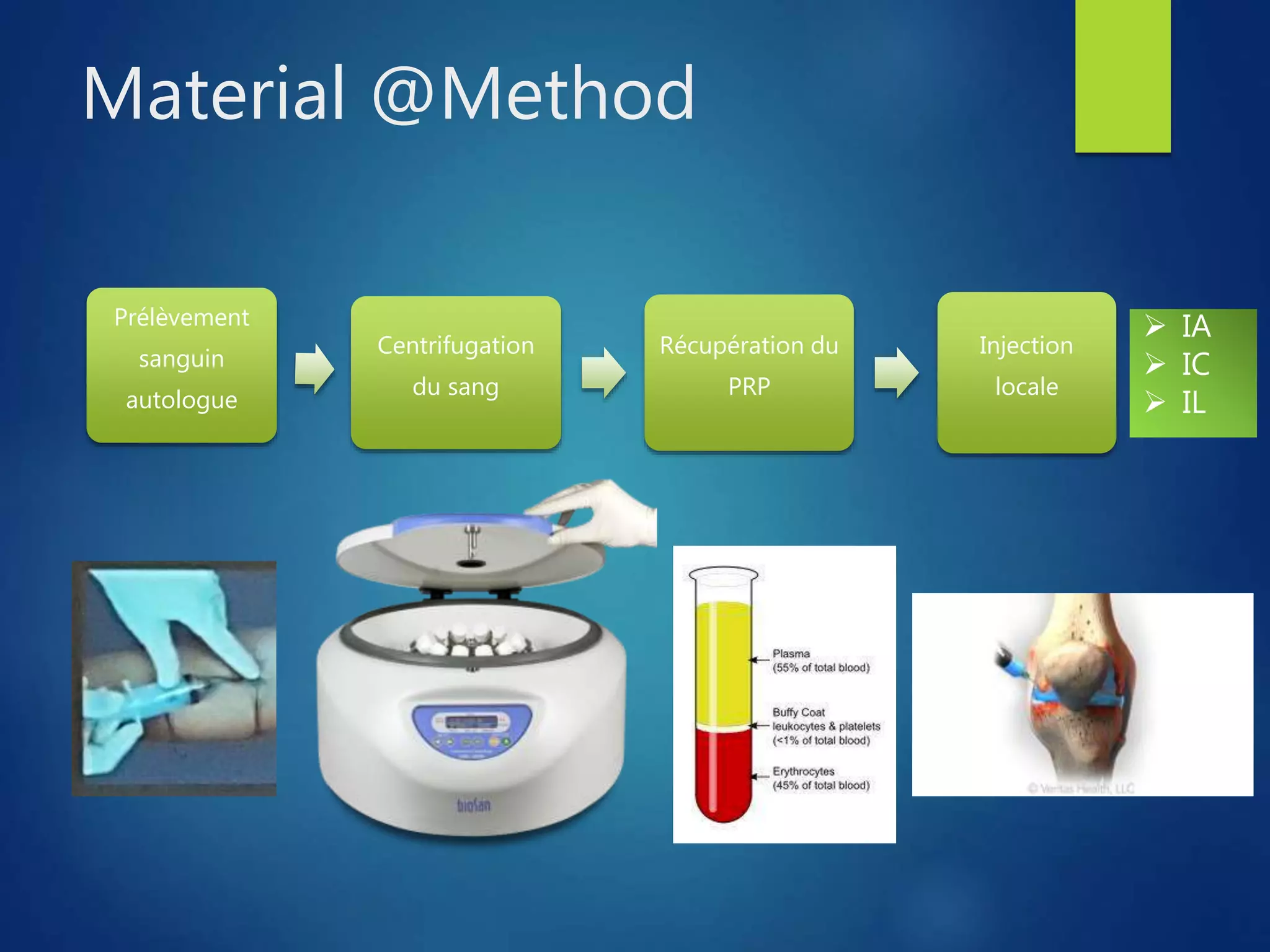 Knee osteochondritis and platelet rich plasma | PPTX