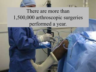 There are more than
1,500,000 arthroscopic surgeries
performed a year.
 