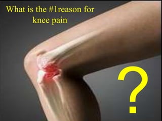 What is the #1reason for
knee pain
 