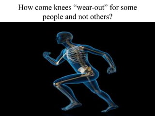How come knees “wear-out” for some
people and not others?
 