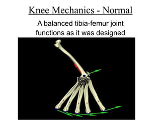 Knee Mechanics - Normal
A balanced tibia-femur joint
functions as it was designed
 