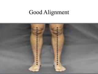 Good Alignment
 