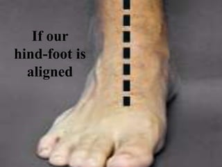 If our
hind-foot is
aligned
 