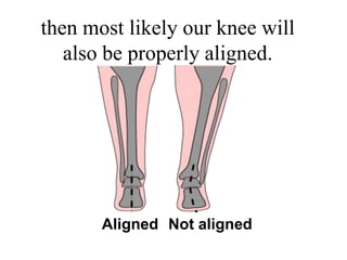 then most likely our knee will
also be properly aligned.
Aligned Not aligned
 
