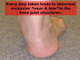 Every step taken leads to abnormal
excessive “wear & tear” to the
knee joint structures.
 