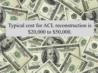 Typical cost for ACL reconstruction is
$20,000 to $50,000.
 